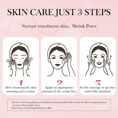 Niacinamide Serum Dark Spot Remover Fade Acne Marks Hyperpigmentation Shrink Pores Even Skin Tone Moisturizing Korea Skin Care 3